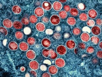 Es gibt Impfstoffe, die den Mpox-Krankheitsverlauf mildern können. (Archivbild)
